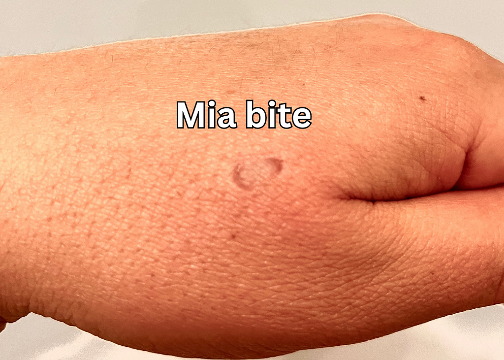 My Parrot is Biting, Why! And What Can I Do?! Poodles and Parrots